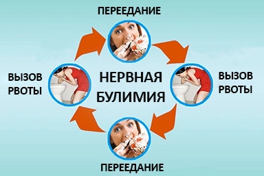 Лечение булимии в Солонцах